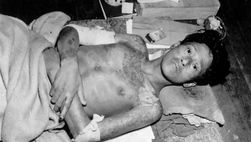 80 Yıl Sonra Nagasaki'den Dünyaya Uyarı: Nükleer Tehdit Yeniden Gündemde